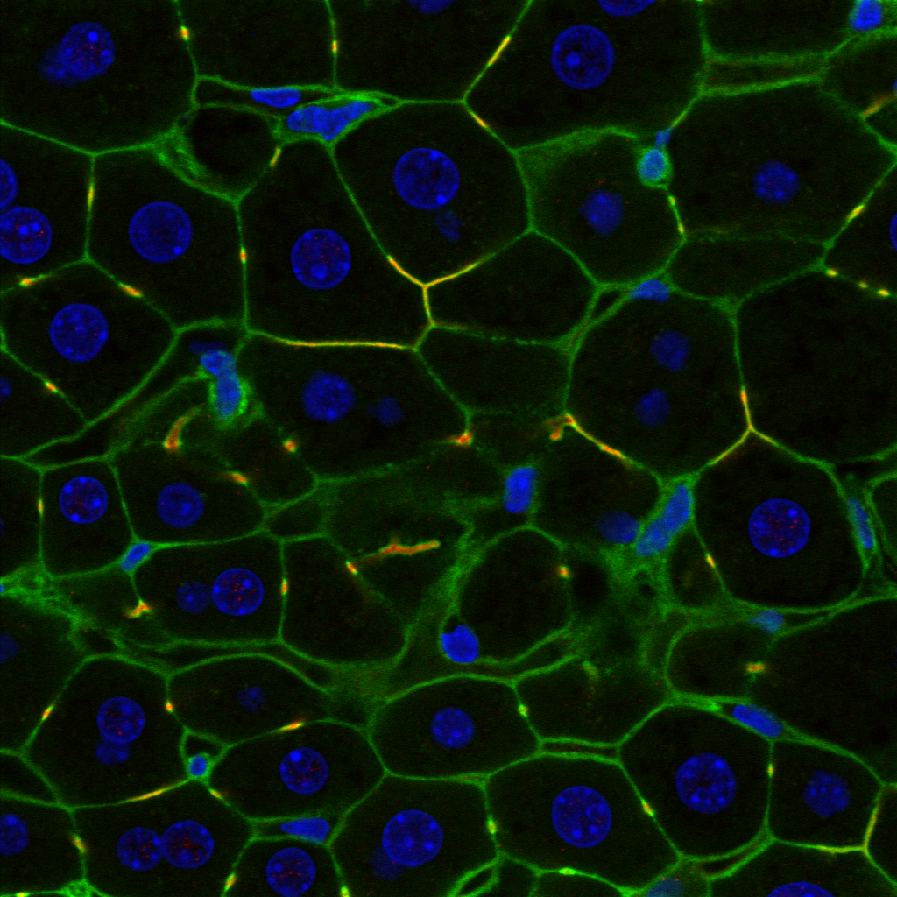vl-scales/intercellular.png